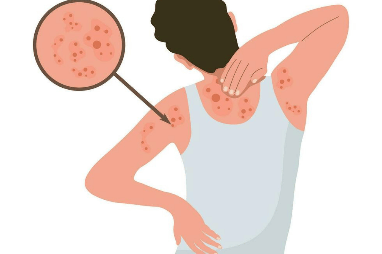 9 Warning Signs of Vitamin D Deficiency and How to Fix It